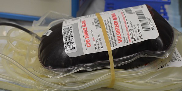 Optimisation du processus de transfusion sanguine